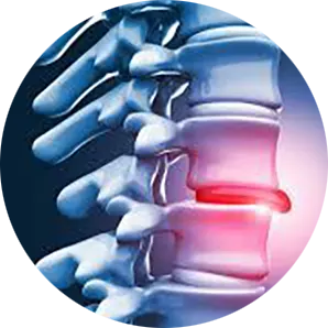 Disc Injury Treatment Near Me in Wheaton, IL. Chiropractor For Disc Injury Pain Relief.